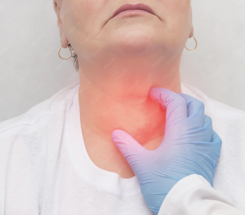 Advanced Thyroid Function Blood Test