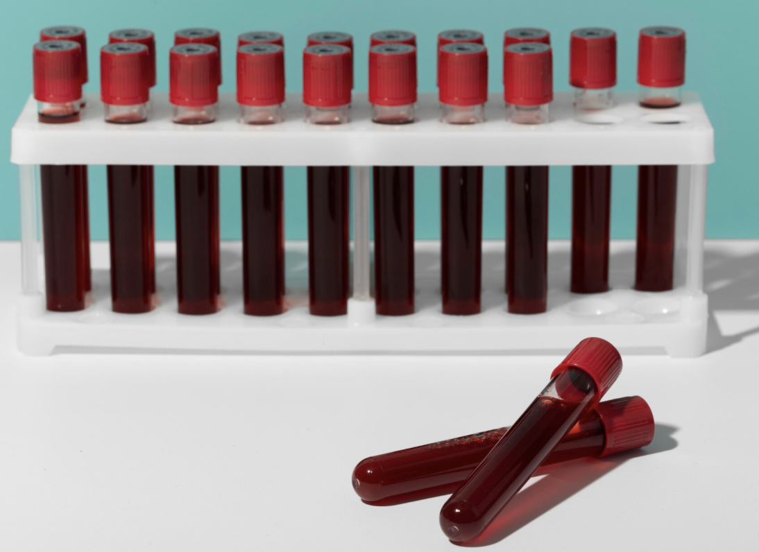 Blood group ABO type Blood Test