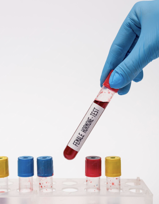 Essential Female Hormones Blood Test