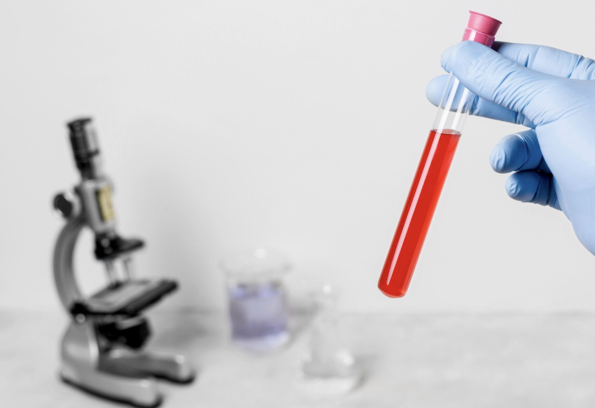 Full Biochemistry and Haematology Blood Test