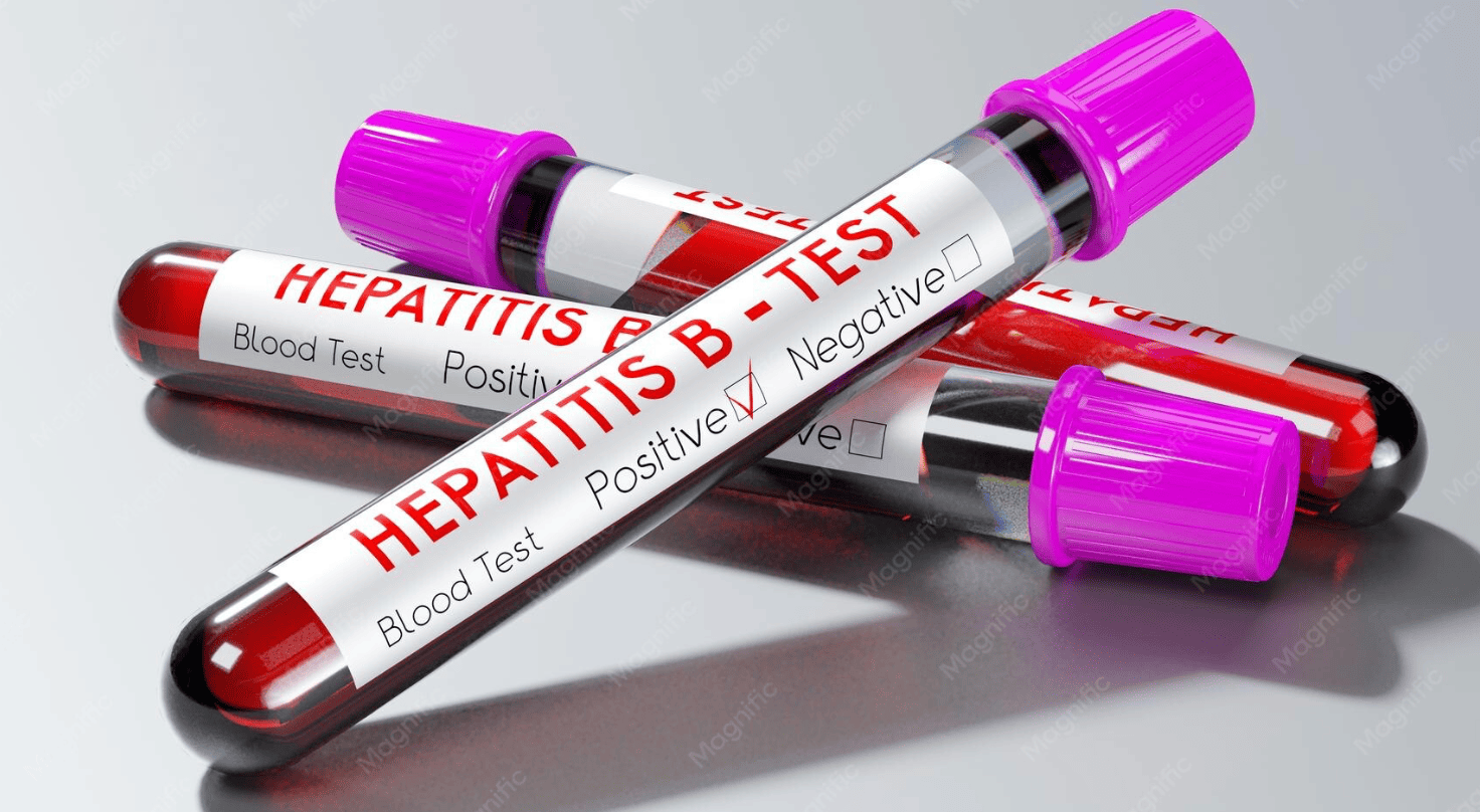 Hepatitis B