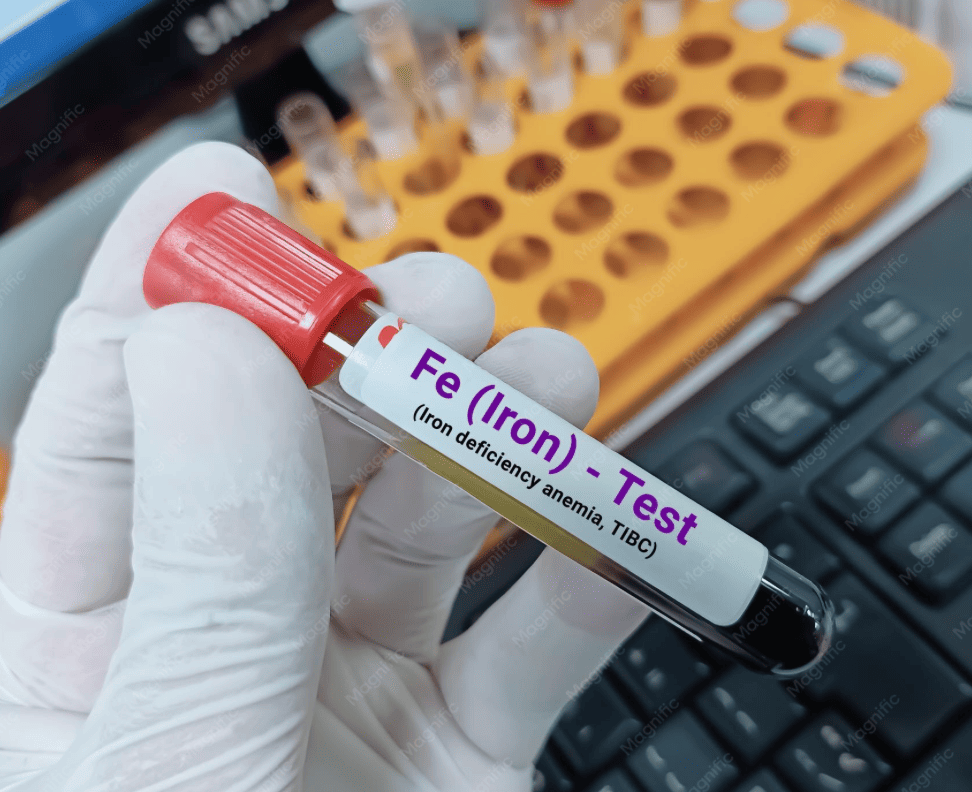 Iron Status Blood Test