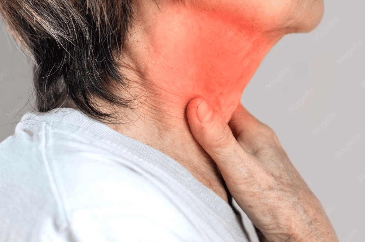 Sore throat