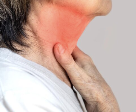 Pharmacy First - Sore throat