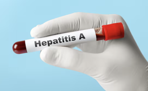 Hepatitis A